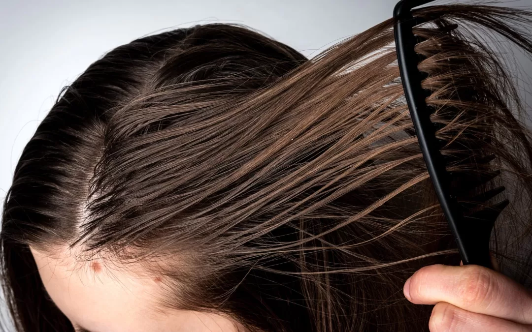 Guía para cuidar tu cabello graso de forma natural